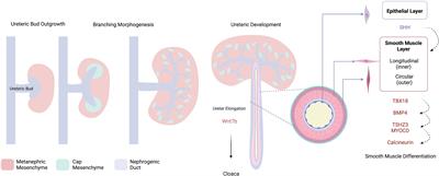 Understanding ureteropelvic junction obstruction: how far have we come?